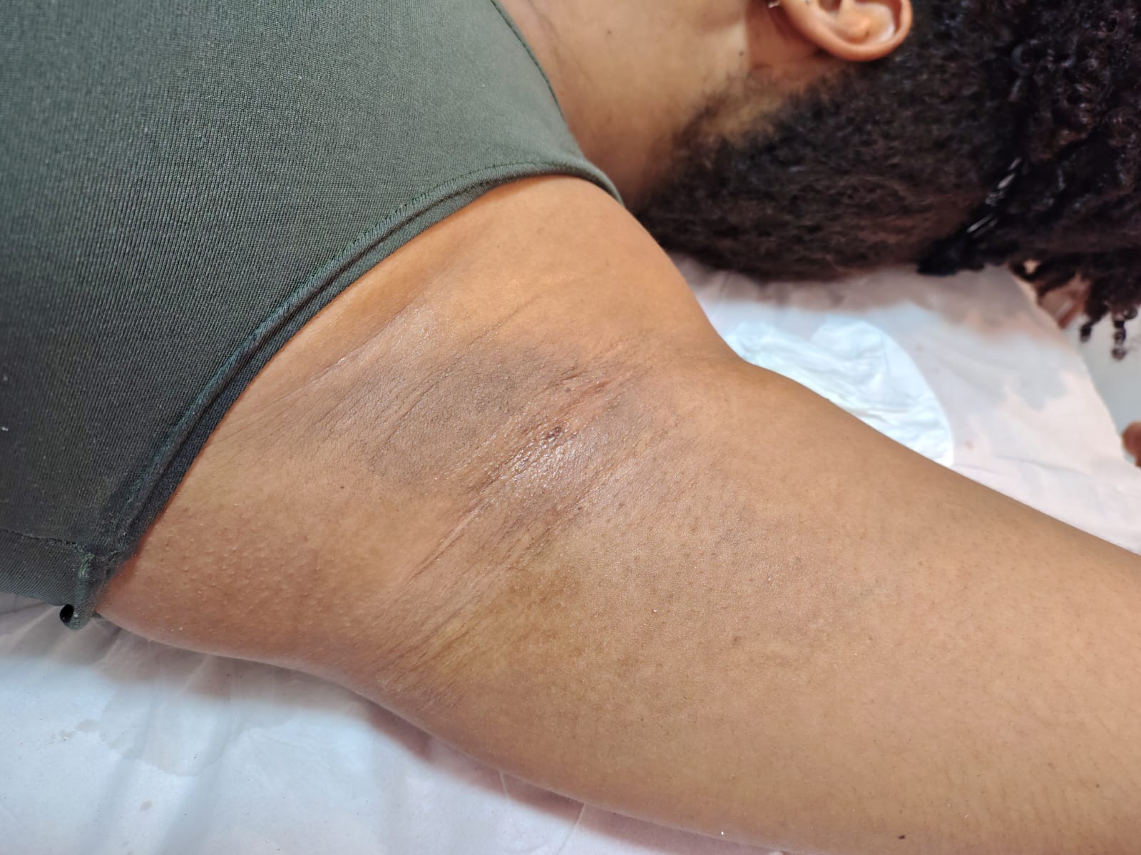 Pele lisinha pós epilação humanizada